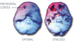 prefrontal cortex